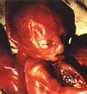 Murdered little innocent baby