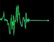 Heart Moniter